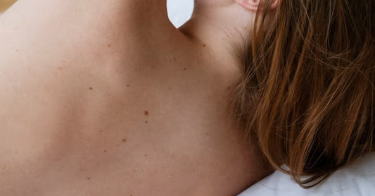 Exploring the Causes of Skin Tags on Specific Body Areas