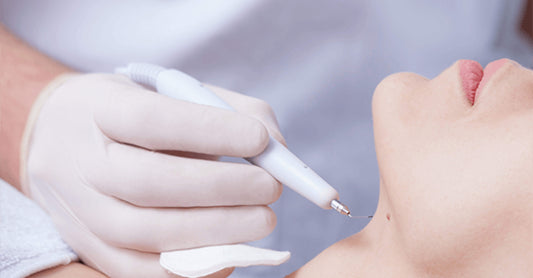 How Do Dermatologists Remove Skin Tags? (2023)
