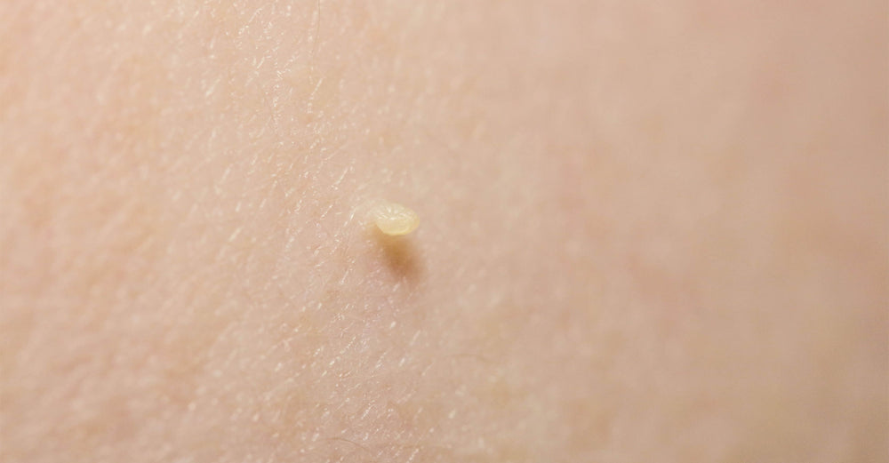 Skintify Blog