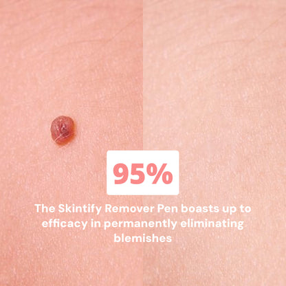 Skintify™ Remover Pen for Moles, Skin Tags, Warts, Age Spots, Freckles | Starter Kit