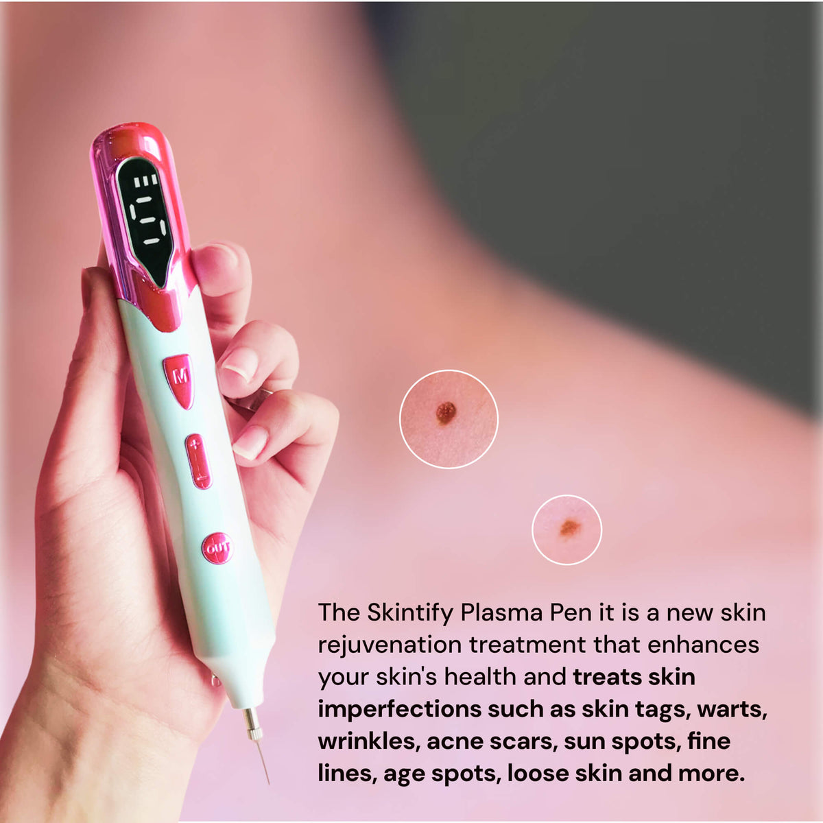 Skintify™ Remover Pen for Moles, Skin Tags, Warts, Age Spots, Freckles